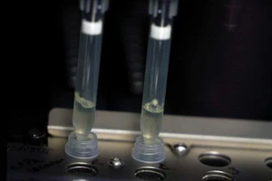 Hai mẫu bệnh phẩm nghi ngờ nhiễm virus đậu mùa khỉ đang trong quá trình xét nghiệm tại phòng thí nghiệm vi sinh, Bệnh viện La Paz, Madrid, Tây Ban Nha, ngày 1/6/2022. (Ảnh: Reuters)