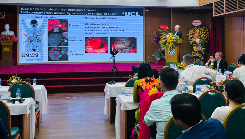 Chuyên gia quốc tế báo cáo cập nhật những tiến bộ mới nhất về chẩn đoán, điều trị ung thư đường tiêu hóa.