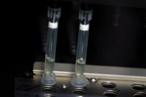 Hai mẫu bệnh phẩm nghi ngờ nhiễm virus đậu mùa khỉ đang trong quá trình xét nghiệm tại phòng thí nghiệm vi sinh, Bệnh viện La Paz, Madrid, Tây Ban Nha, ngày 1/6/2022. (Ảnh: Reuters)