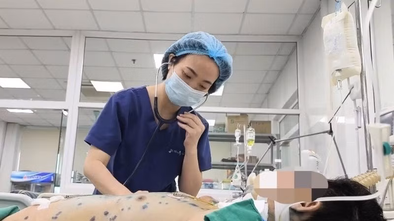 Điều trị bệnh đậu cho người lớn tại Bệnh viện Bệnh nhiệt đới Trung ương