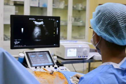 Ê-kíp đốt u gan bằng sóng cao tần (RFA).