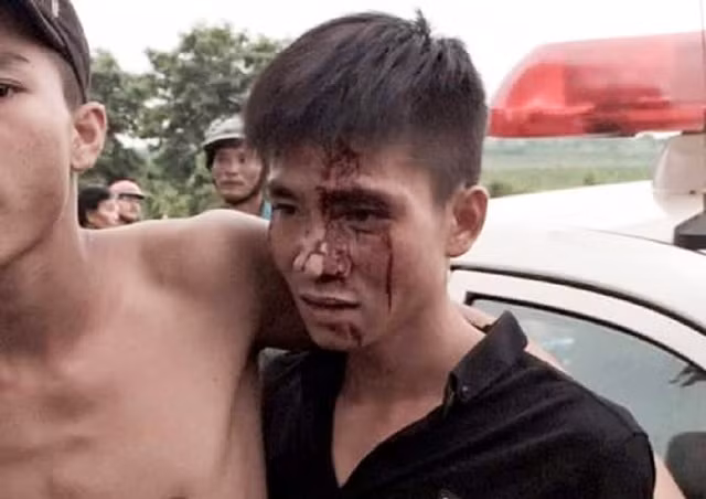 Thanh niên bị chảy máu đầu liên quan vụ việc.