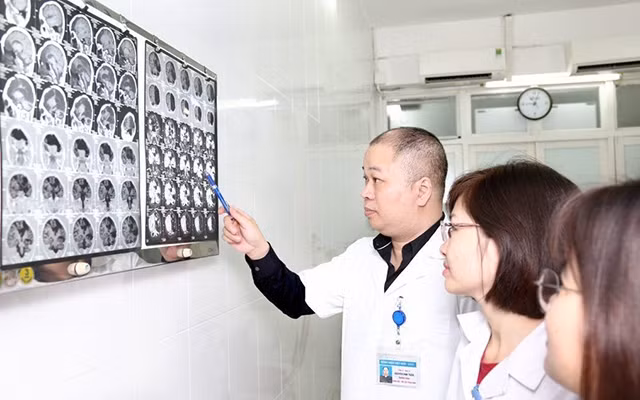 Đột quỵ ở người trẻ đang gia tăng đáng báo động