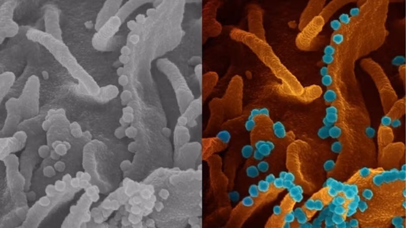 Hình ảnh virus SARS-CoV-2 giải phóng từ một tế bào sắp chết