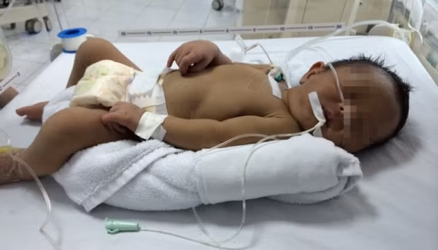 Cháu D. hiện đang được các bác sĩ điều trị tích cực. (Ảnh: Khánh Chi) 