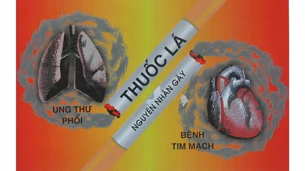 Ảnh minh họa: Vinacosh.