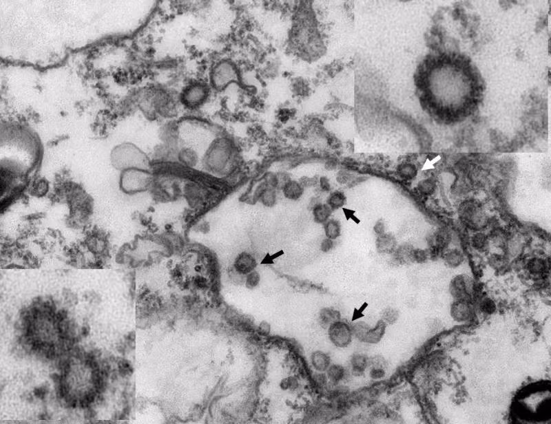 Tìm thấy điểm tương đồng giữa SARS-CoV-2 và virus corona ở tê tê ảnh 3
