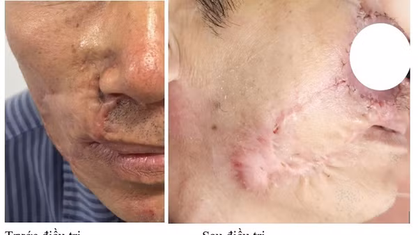Hình ảnh bệnh nhân trước và sau điều trị. 