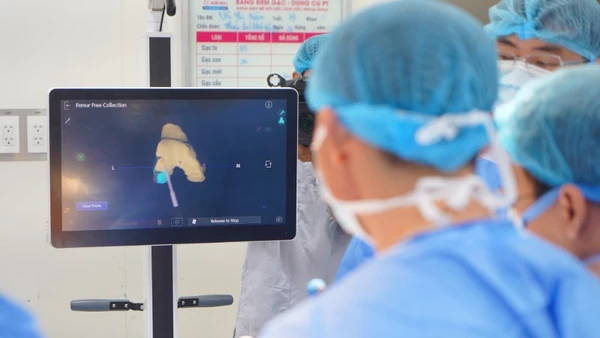 Công nghệ thay khớp gối toàn phần dưới sự hỗ trợ của robot CORI mang lại độ chính xác gần như tuyệt đối trong từng thao tác.