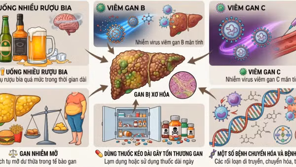 Các nguyên nhân gây bệnh xơ gan. (Ảnh: BVCC)
