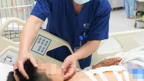 Năm ngày giành giật sự sống cho bệnh nhi 9 tuổi bị tai nạn từ kíp nổ tự chế