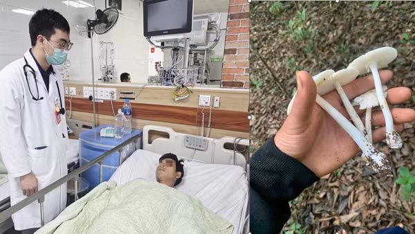 Các nạn nhân ăn nấm độc cấp cứu tại Trung tâm Chống độc, Bệnh viện Bạch Mai.