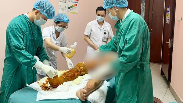 Bệnh nhân nhập viện trong tình trạng bỏng nặng vùng đùi. 