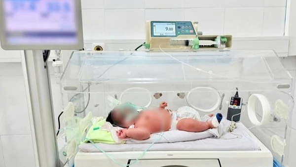 Em bé chào đời nặng 6,2kg. (Ảnh: BVCC)