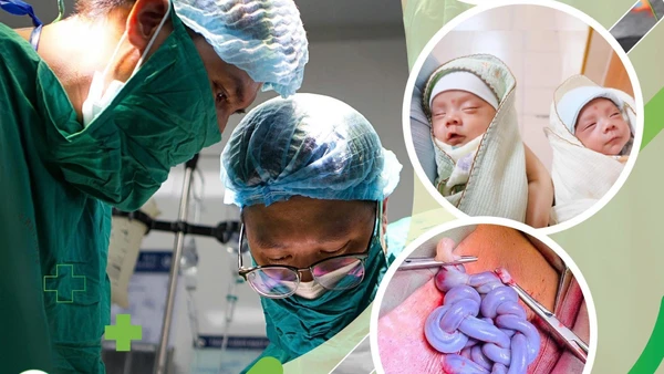 Hai bé gái chào đời ở tuần thai 30 an toàn. 