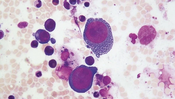 Parvovirus B19 tập trung lây nhiễm ở các tế bào phân chia nhanh, gây độc làm cho tế bào chết nhanh và gây viêm xung quanh. (Ảnh minh họa)