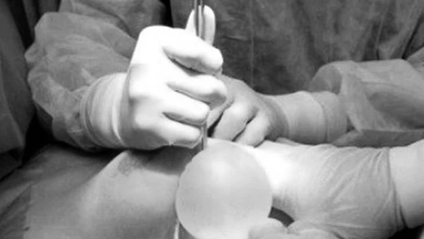 Các bác sĩ thực hiện phẫu thuật hút dịch mủ ngực cho bệnh nhân.