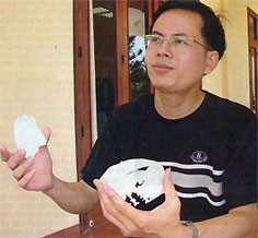 Công nghệ "hàn" sọ, thay khớp xương của một Việt kiều