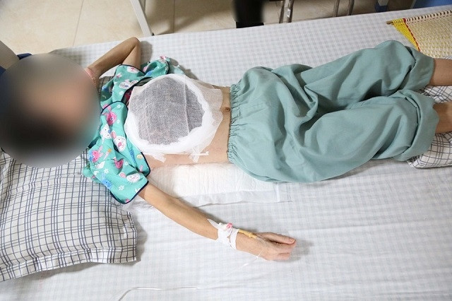 Cẩn thận khi dùng thuốc nam chữa ung thư