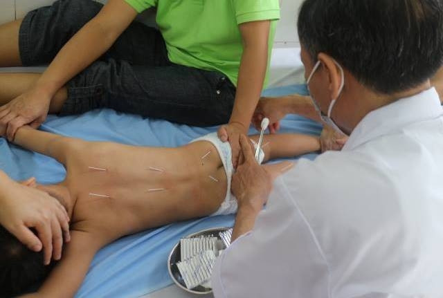 Điều trị trẻ tự kỷ bằng y học cổ truyền