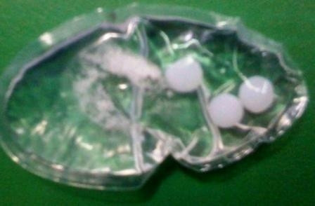 Túi dung dịch có chứa “thuốc lạ” lấy ra từ các áo ngực