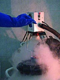 Bảo quản tinh trùng tại BV Từ Dũ.