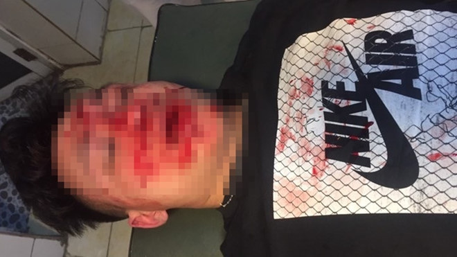 Bác sĩ bị hành hung. (Ảnh: Báo Thanh niên)