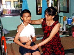 Bệnh nhi Thành bị xơ hóa cơ Delta -
được phẫu thuật ngày 15-6.