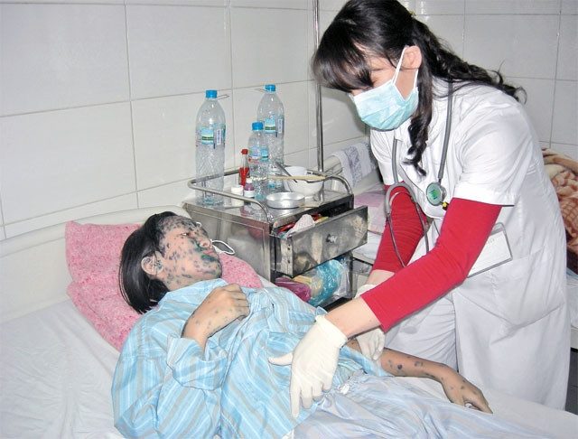 Bác sĩ Bệnh viện Bệnh nhiệt đới Trung ương khám cho người bệnh mắc thủy đậu.