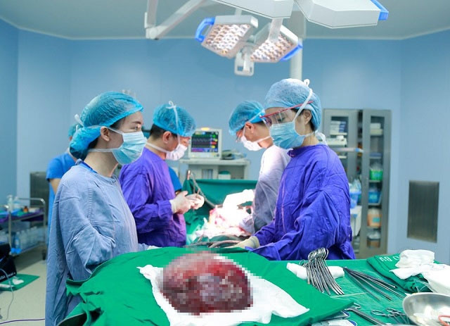 Khối u kích thước 30 cm vừa được các bác sĩ loại bỏ.