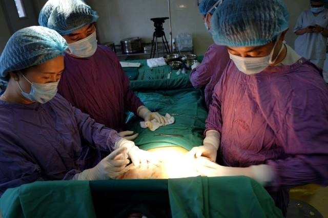 Tạo hình thành công cho một người phụ nữ phì đại tuyến vú khổng lồ