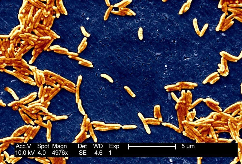 Vi khuẩn Salmonellae nhìn dưới kính hiển vi.