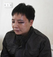 Lạng Sơn: Thành lập tổ công tác điều tra vụ hành hung nhà báo