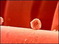 Lần đầu tiên tạo ra được tế bào gốc phù hợp với từng cơ thể bệnh nhân