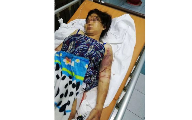 Chị Y khi điều trị tại bệnh viện.