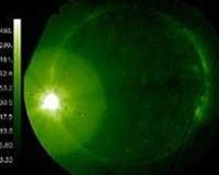 Vệt đen trên Mặt trời do một
vệ tinh chụp tuần trước.