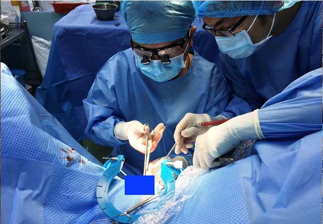 Các bác sĩ Bệnh viện Bình Dân thực hiện phẫu thuật lấy dị vật cho bệnh nhân.