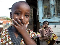 Cứ 5 trẻ em Nigeria <br> thì có một trẻ chết <br> trước khi lên 5 tuổi.