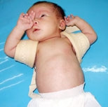 Băng số 8 cố định
xương đòn bị gẫy cho trẻ.