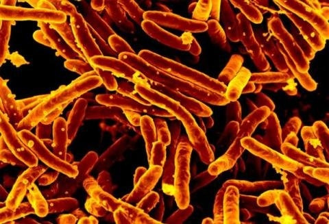 Hình ảnh quét vi điện tử của vi khuẩn Mycobacterium tuberculosis, gây bệnh lao. 