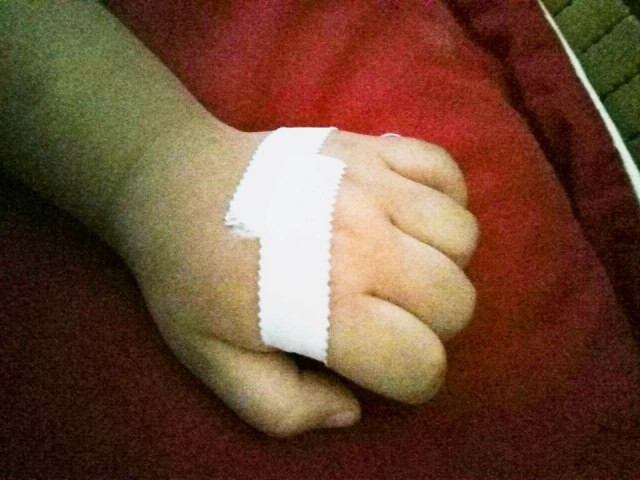 Tay của bé H đã có thể cử động bình thường. 