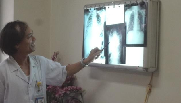 Bác sĩ Nguyễn Tiến Dũng giải thích về phim chụp phổi của bệnh nhi Nguyễn Đăng Đan.