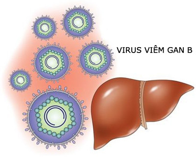 Việt Nam có tỷ lệ người nhiễm virus viêm gan B cao