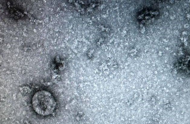 Ngày 7-2, Viện vệ sinh dịch tễ Trung ương đã nuôi cấy và phân lập thành công virus corona mới.