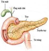 Viêm tuỵ cấp ở trẻ