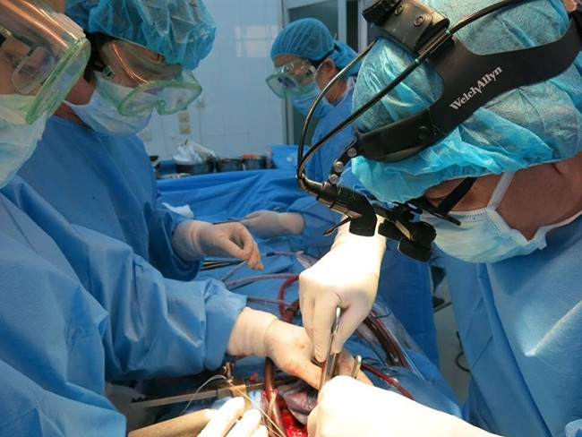 Ê kíp thực hiện ca phẫu thuật.