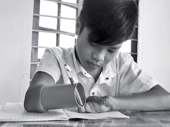 Nghị lực của cậu bé khuyết tật