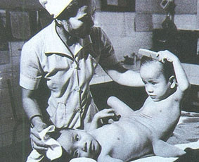 Ảnh chụp cặp song sinh Việt - Đức năm 1984.