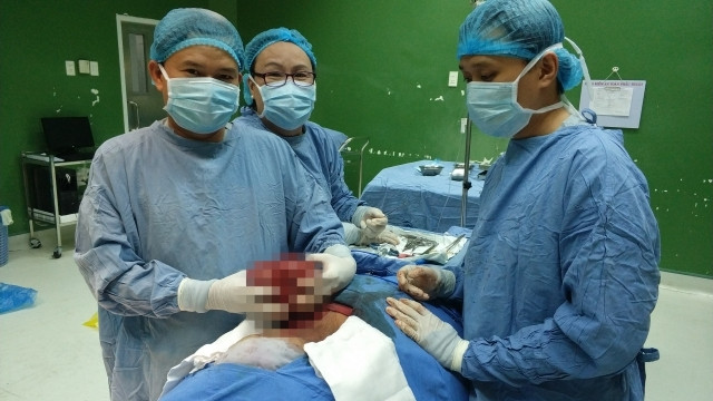 Các bác sĩ Bệnh viện Đà Nẵng mổ, tách thành công khối u ra khỏi cổ bệnh nhân. (Ảnh: Bệnh viện Đà Nẵng cung cấp)