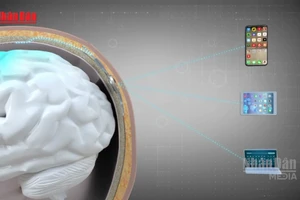 [Video] Trung Quốc cho phép loại chip gắn não đầu tiên được sử dụng lâm sàng 